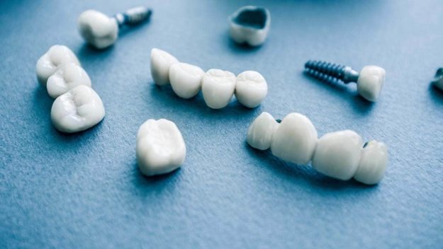 Do I need Dentures or Dental Implants_ examples of options when someone asks Do I need dentures or dental implants