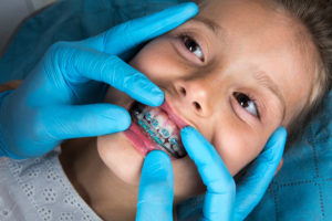 dentist checking on young girl's dental braces in TX