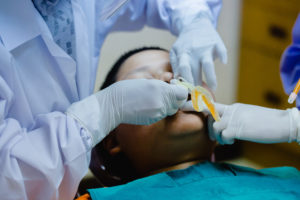 person in the midst of fluoride treatments in TX after making an appointment for a fluoride treatment in sugar land tx