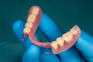 dentist holding a dentures insert