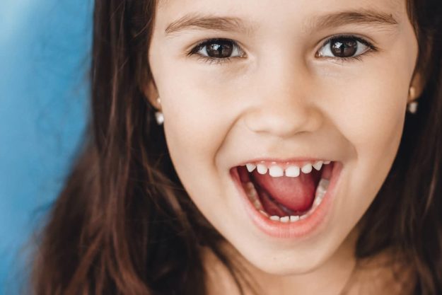 cavity prevention (1) Girl shows teeth after successful cavity prevention.