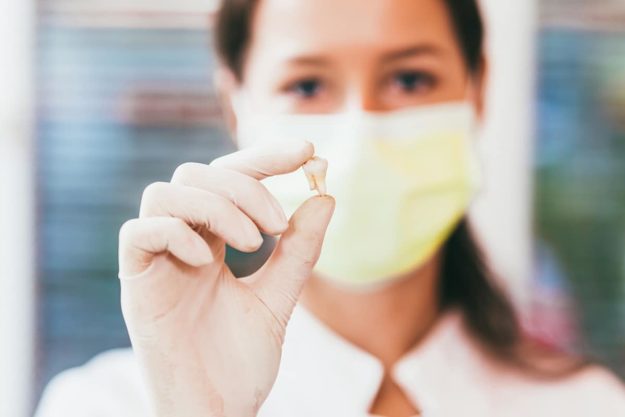 tooth extraction dentist holding a tooth from a tooth extraction