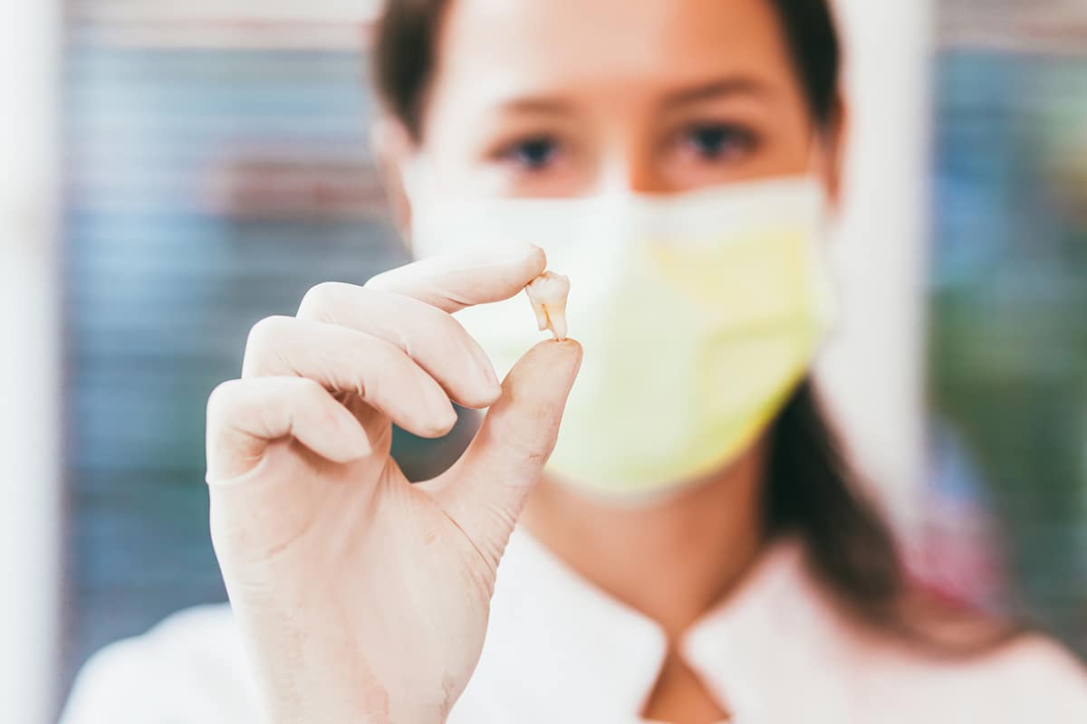 dentist holding a tooth from a tooth extraction