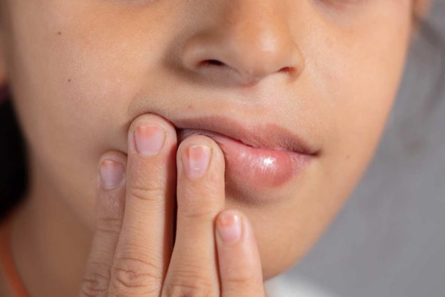 oral cancer woman concerned about oral cancer