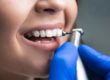 woman receiving teeth cleaning services