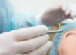 dentist explaining a dental implant